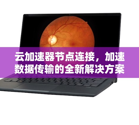 云加速器节点连接，加速数据传输的全新解决方案
